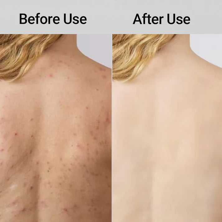 SkinFloss™ — Dual-Texture Exfoliating Towel