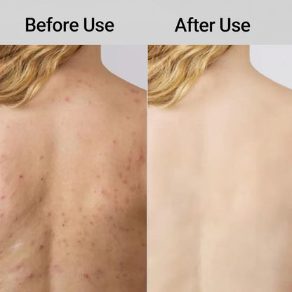 SkinFloss™ — Dual-Texture Exfoliating Towel